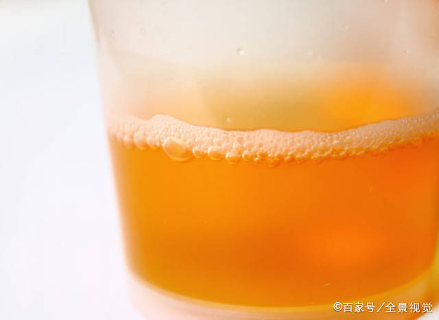 工作量|肝病不能拖，一旦上厕所时发现这5种情况，多半是肝脏在“求救”