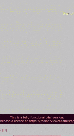 300_549 竖版 竖屏