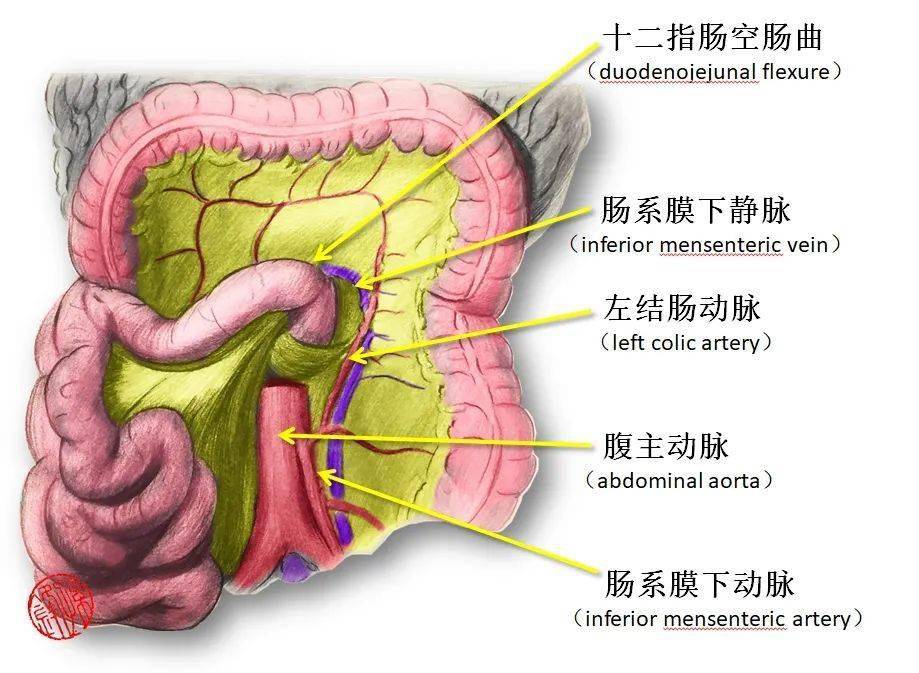 图(4):肠系膜下静脉(imv)与十二指肠空肠曲的解剖关系