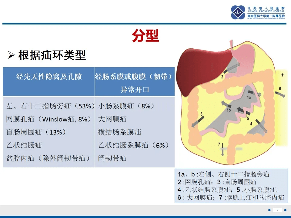 详解腹内疝分型与影像表现