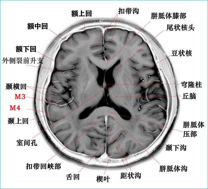 这个高清颅脑断层解剖图谱实在太棒了【磁共振 大体标本】