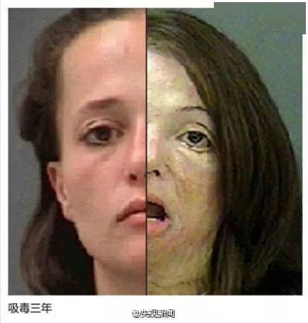 甲卡西酮类物质的危害还不止于此,除了能导致急性健康问题和精神依赖
