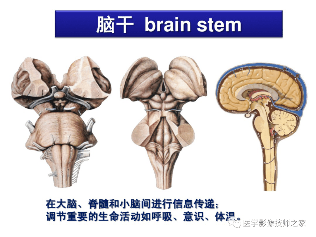 几个常见的脑干病变症侯群1,大脑脚综合征(weber's综合征:表现为:动