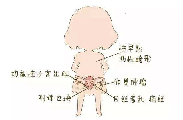 痛当下腹部或盆腔,腰部,肛门会阴等部位出现疼痛感就需要注意了.