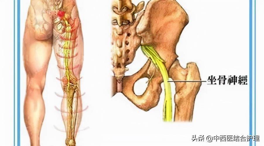 配殷门,阳陵泉穴,委中穴,昆仑穴,有疏通经络,活血止痛的作用 治坐骨