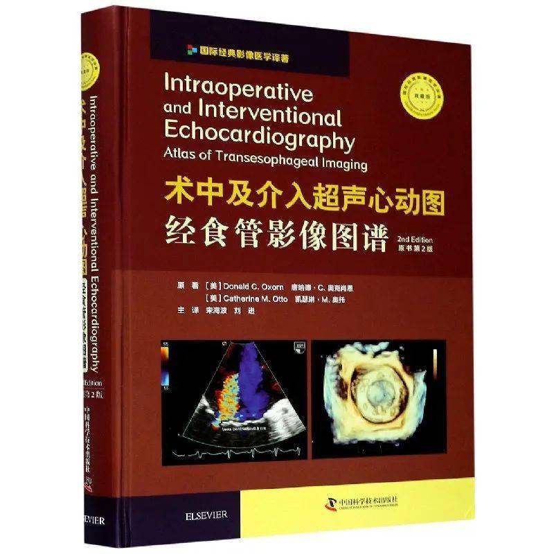 新颖,实用,全面的超声心动图工具书