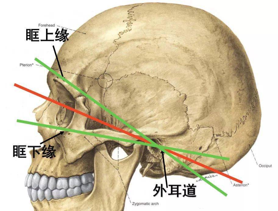 上眶耳线(sml:为外耳道中点与外眦的连线.