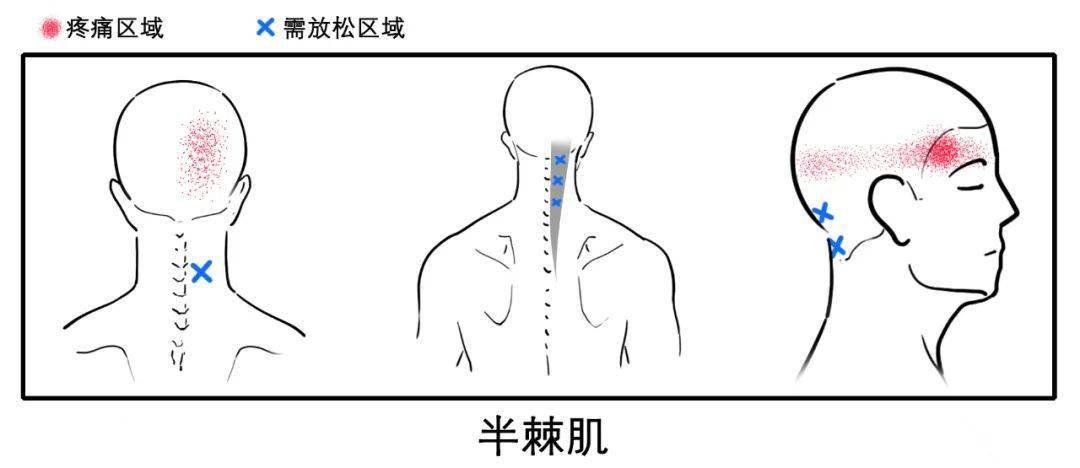 半棘肌,头夹肌,颈夹肌位置接近,且功能类似,可用相同的拉伸动作放松.