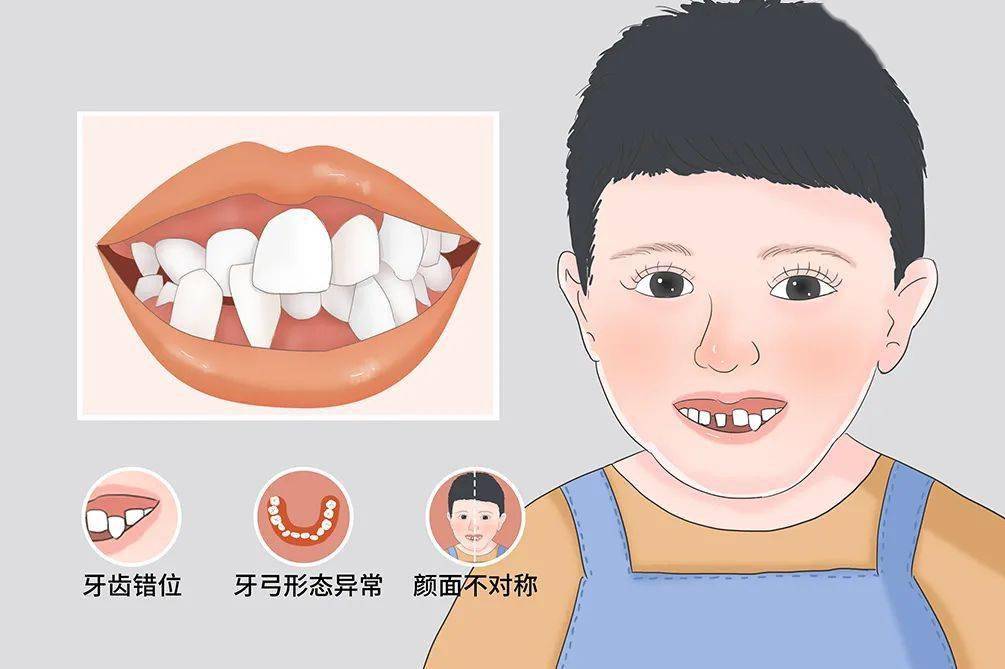 免费防蛀涂氟,并及早发现和解决孩子牙齿,面部发育畸形等问题