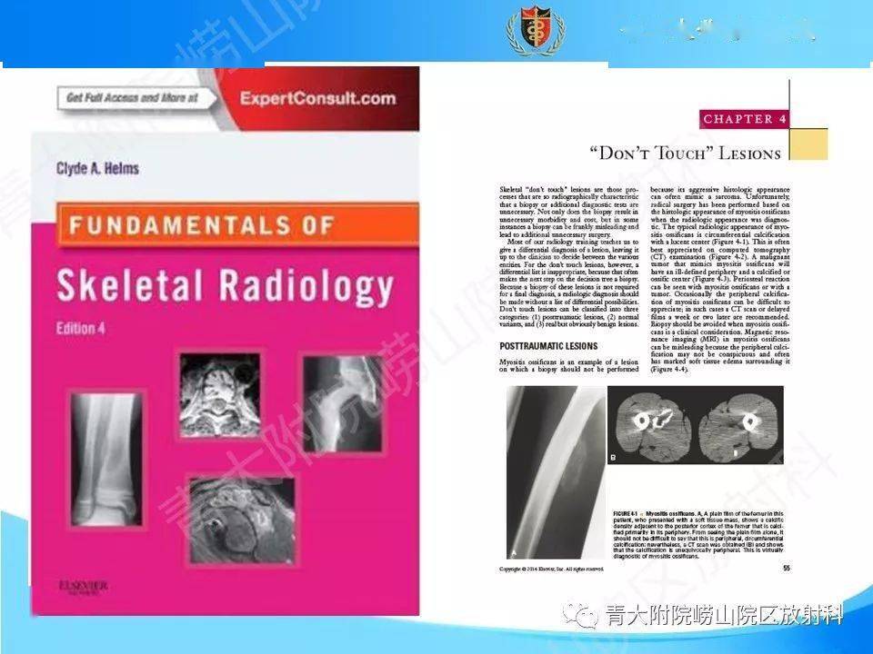 "不要碰"的骨关节病变_全网_影像_解剖图