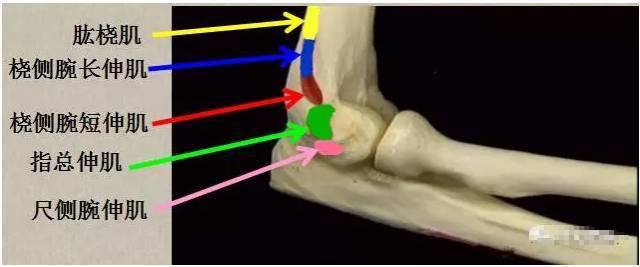 针刀医学认为:肱骨外上髁炎是由频繁地伸指伸腕导致伸肌总腱等软组织