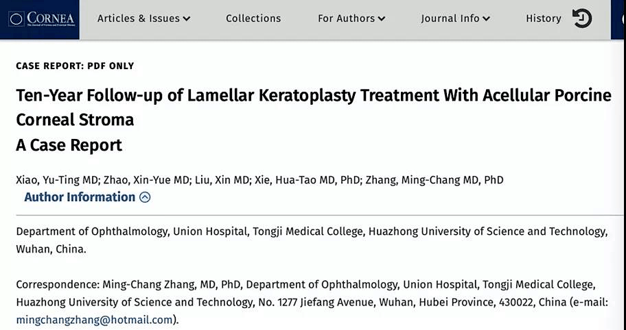 领域著名杂志《cornea》发表论文"ten-year follow-up of lamellar