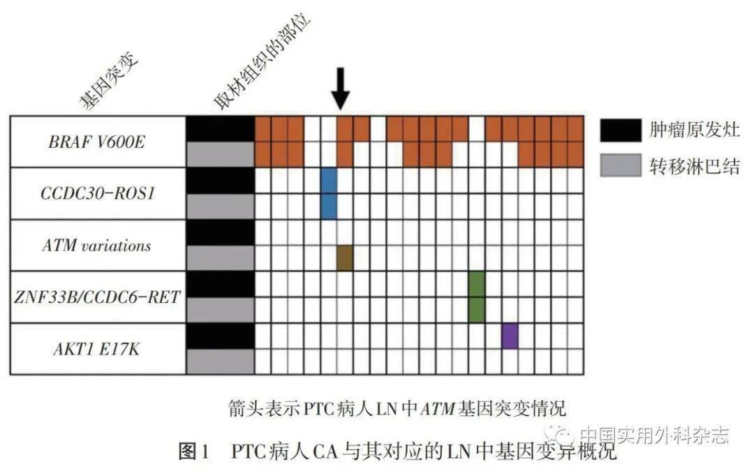 论著|利用高通量测序技术检测甲状腺乳头状癌基因变异