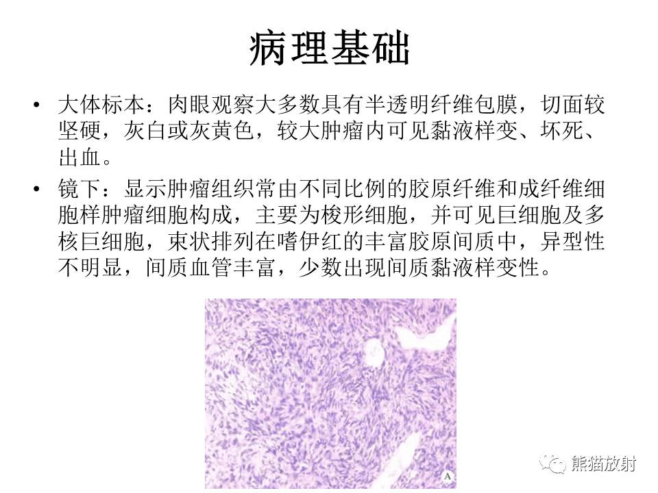 胸膜孤立性纤维瘤,胸壁神经鞘瘤你想到了吗?有收获吗?