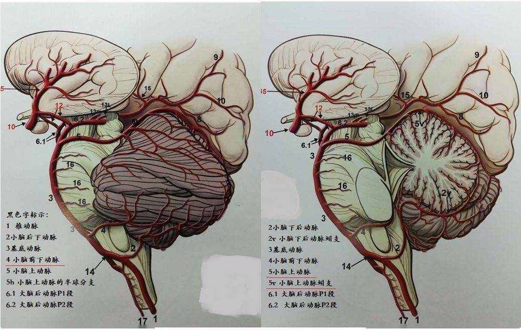 先来看一张脑动脉供血区域图↓一张图读懂脑动脉供血区域红色aca:大脑