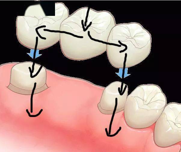 5分钟告诉你他们的区别_牙齿_牙冠_牙根