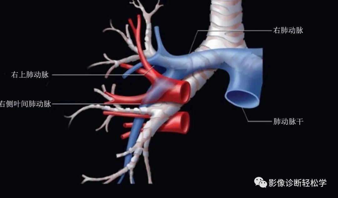 肺部hrct 读片之三: 肺动脉_支气管_直径_小叶