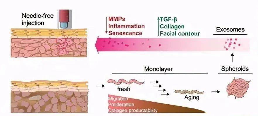 无针注射人真皮成纤维细胞球体的外泌体改善皮肤光老化来自北卡莱罗纳