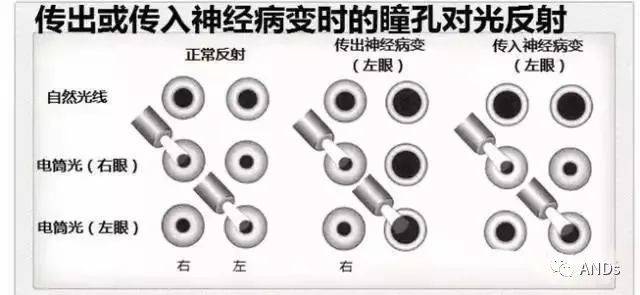 交感神经_瞳孔_感觉