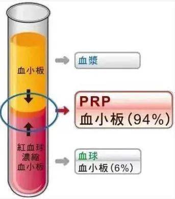 prp富血小板血浆疗法为关节疾病患者解除病痛_治疗_市一医院_血浆