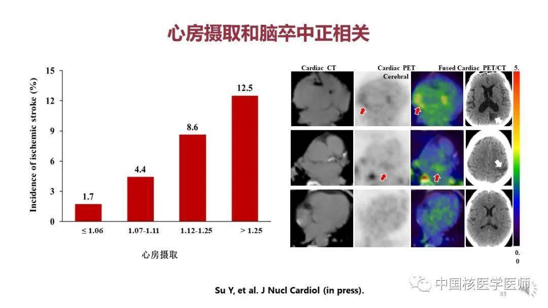 【核汇园】67期:杨敏福教授 fdg心血管显像的拓