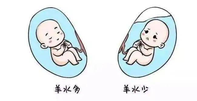 "羊水不够,喝水来凑,真的靠谱?真相在这里_宝宝_子宫_胎儿