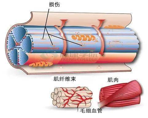 运动后肌肉酸痛的相关机制,争议与缓解_损伤_肌纤维_骨骼肌