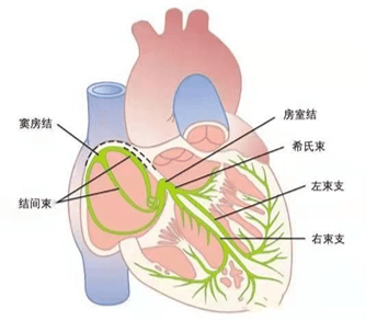 基础知识 左束支传导阻滞患者麻醉管理_时间_分支_检查