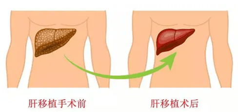 【直播指南】第34期《难治性疼痛与交感神经》直