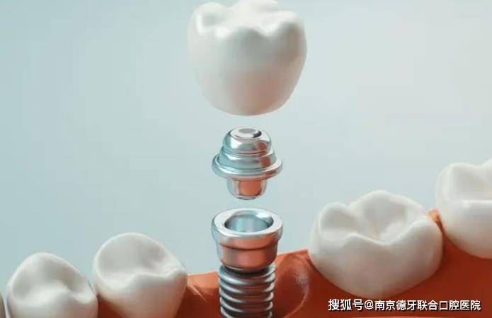 上海助孕哪家好（南京种植牙医院十大排名_南京种植牙价格）