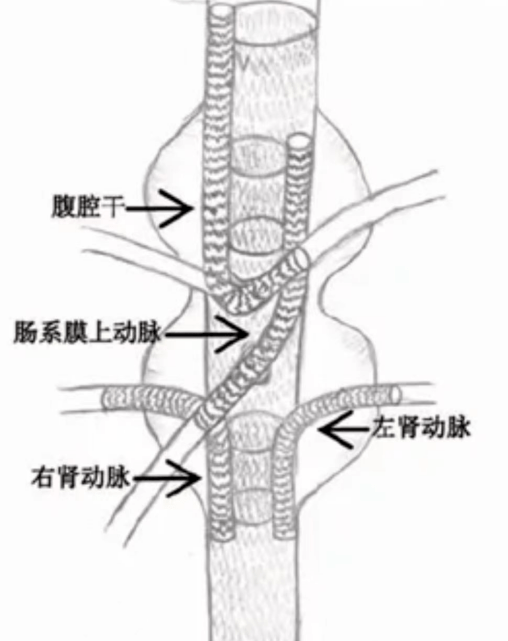 血管_治疗_手术