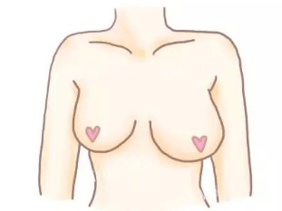 女性胸部一大一小，如何改善？