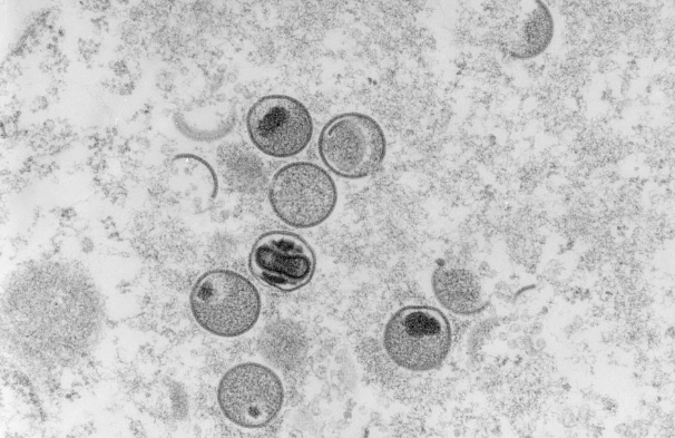 美媒：世界卫生组织计划重新命名猴痘 或为规避“污名化”