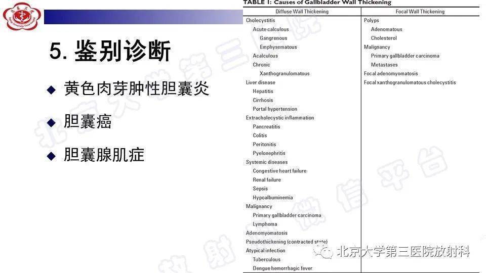 胆囊炎影像诊断