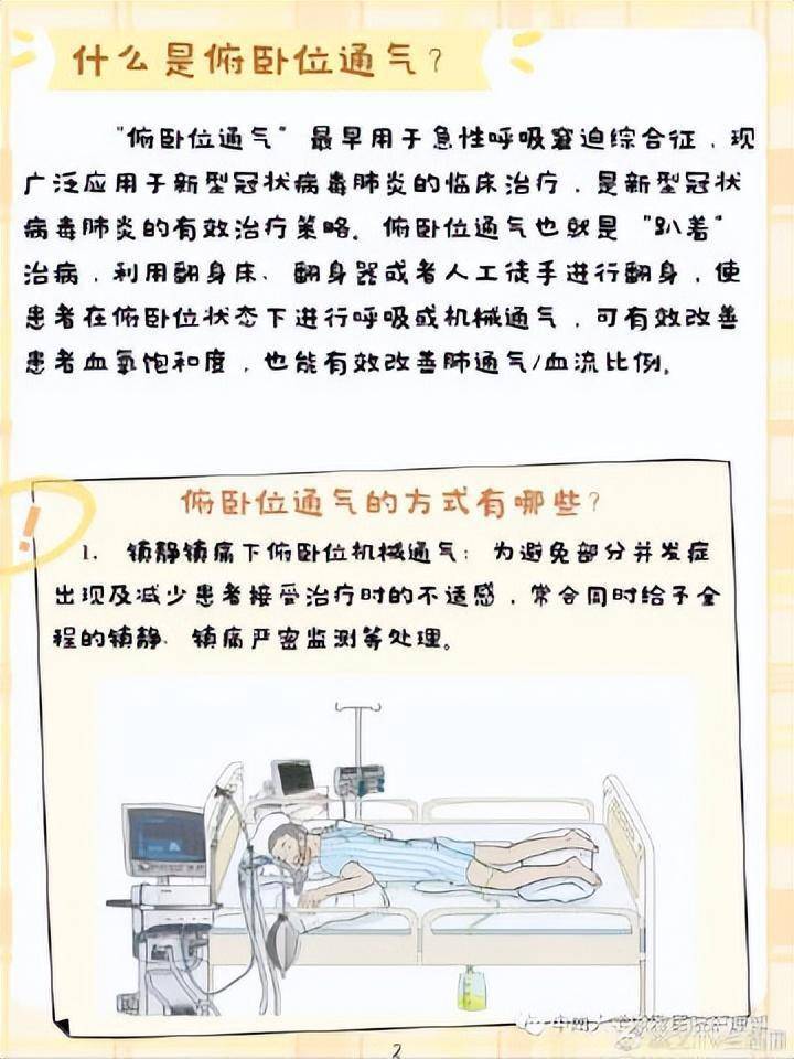 什么是俯卧位通气？