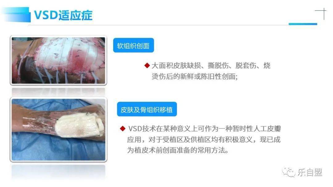 VSD格式是什么？它有哪些特点和用途？  第1张