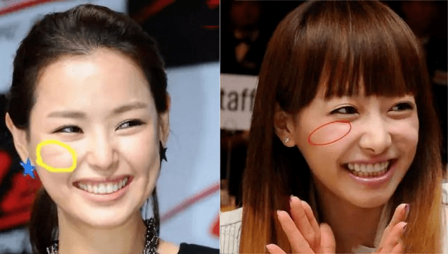 如女星宋茜,笑起来时脸上就会有印第安纹.