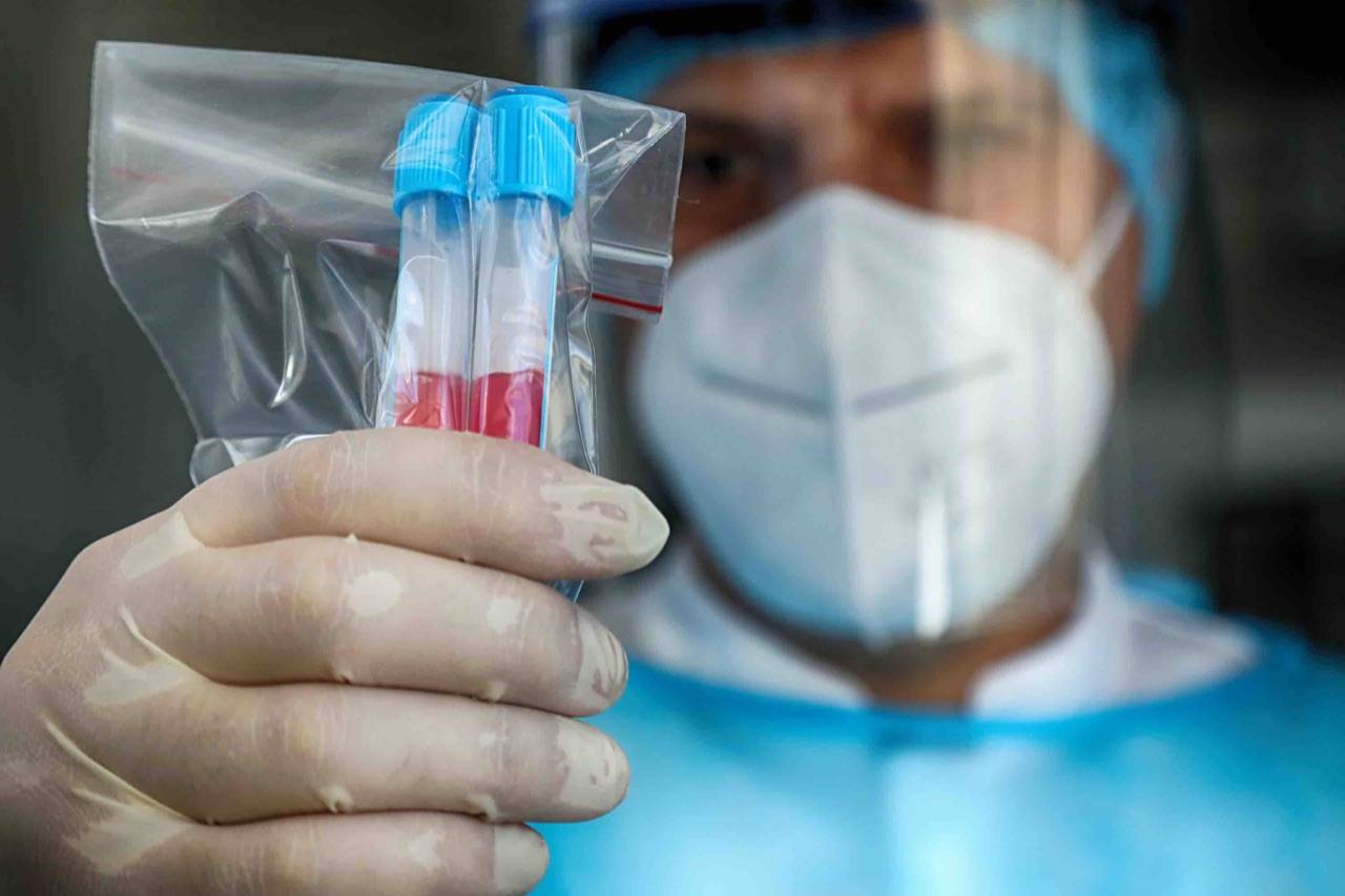 安心复工法拉利为员工及家属提供血清检测