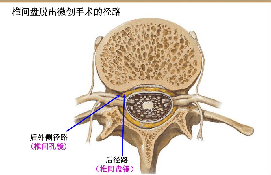 【收藏版】椎间孔镜技术脊柱应用解剖图表