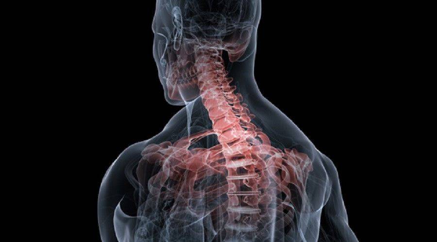 脊柱理疗床加盟颈椎痛总反复往往是胸椎引发却被忽略