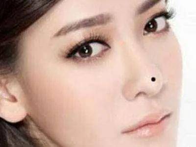 脸上哪些地方有痣异性缘好