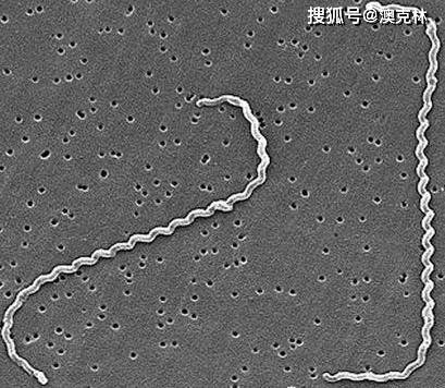 钩端螺旋体细菌样子在显微镜下