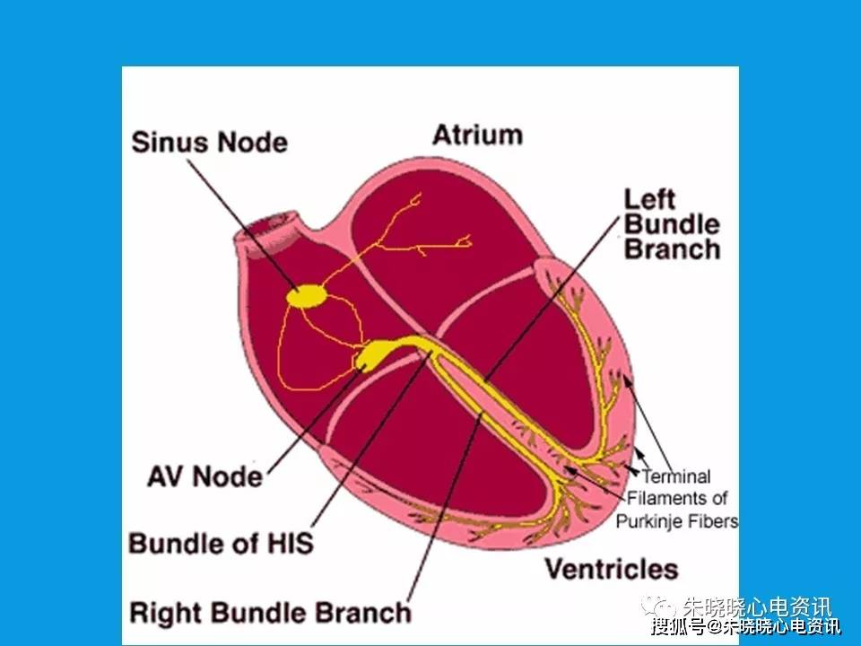 心律失常arrhythmiappt