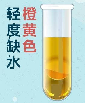 缺水8大症状营养师教你看尿色判断身体缺水情况