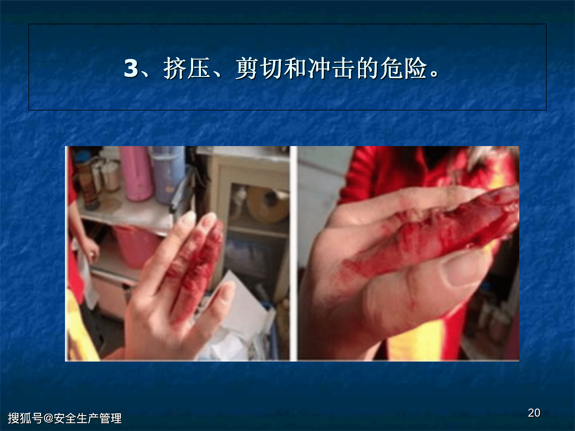 机械安全生产基本知识及事故防范