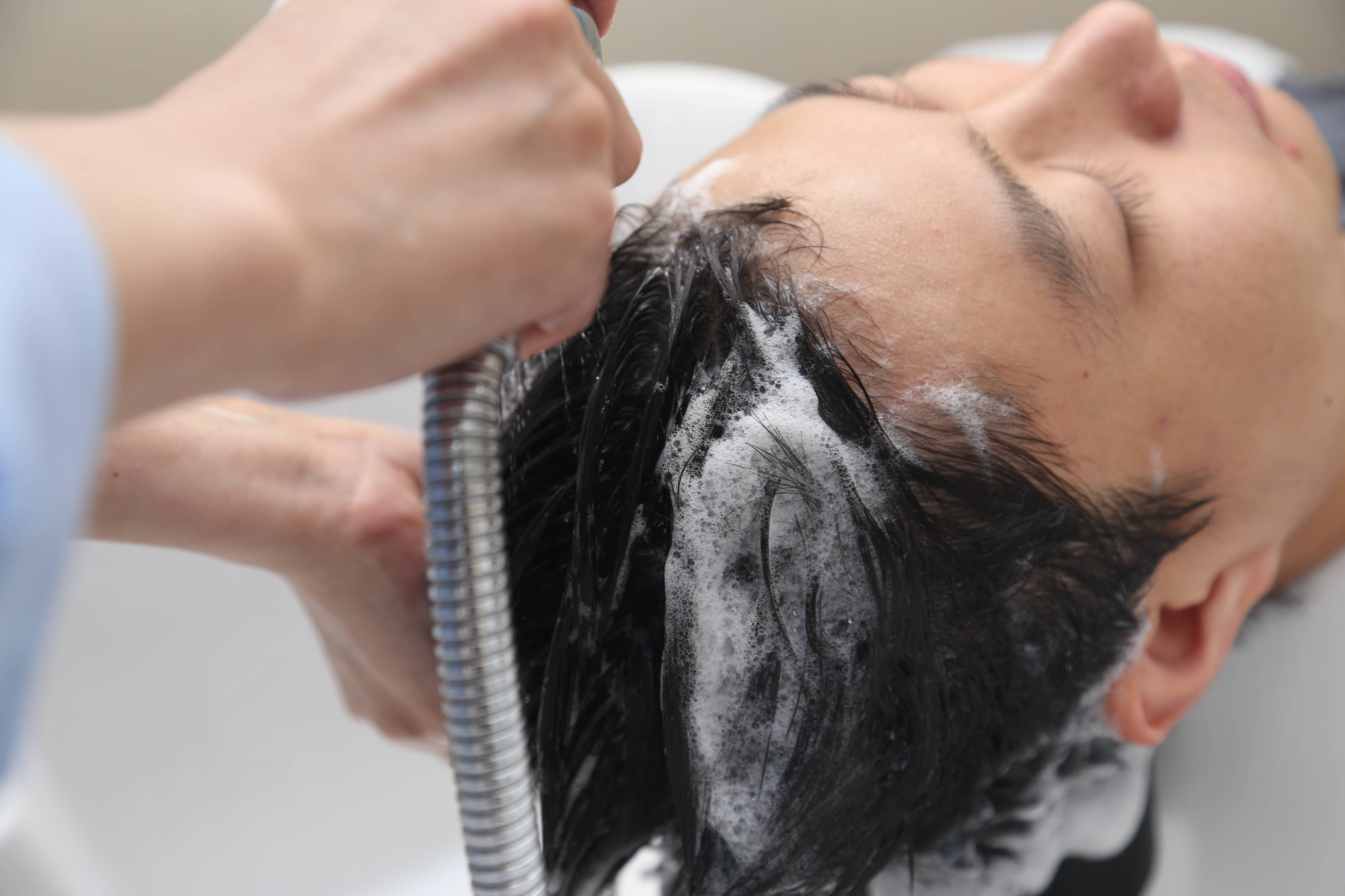 植发最全攻略|手术后护理需要注意哪些事项?_头发