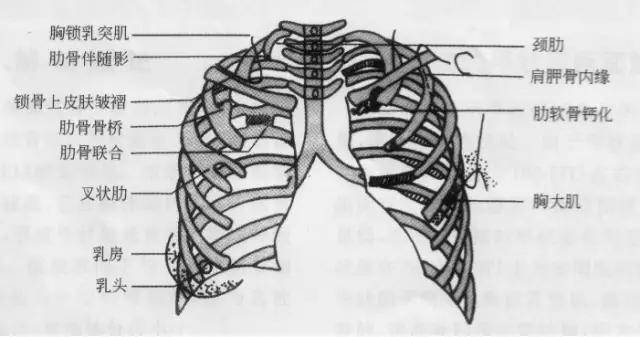 收藏详细的胸部x线解剖最基础最实用