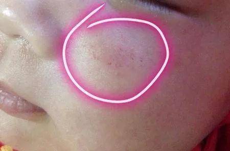 用就烂脸护肤品里的酒精真这么可怕