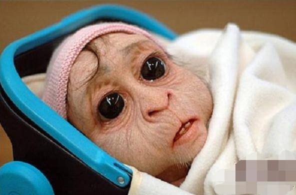 湖南宝妈生下只"猴子",马戏团想高价购入,宝妈的回答让人心酸