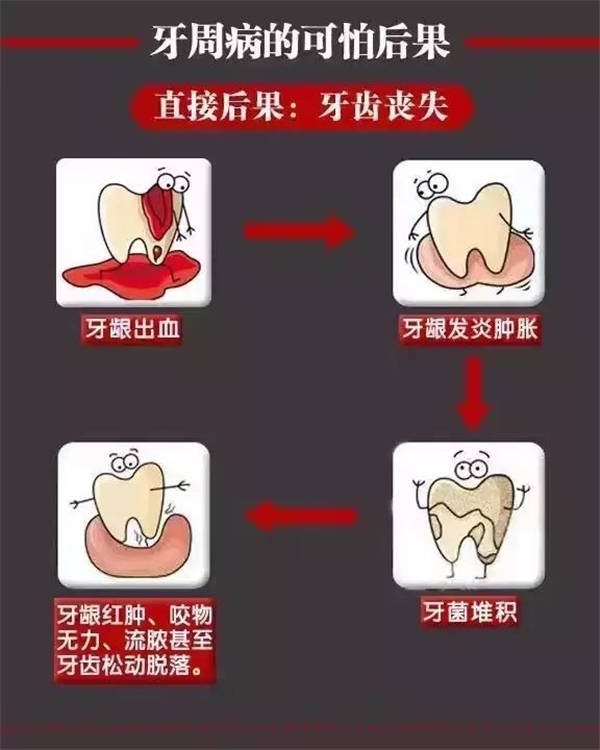 好可怕的牙周病
